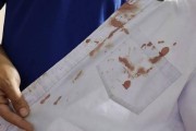 洗衣机清洗剂喷头更换方法（简单易行的清洗剂喷头更换步骤）