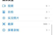 荣耀手机图片永久删除后能恢复吗？