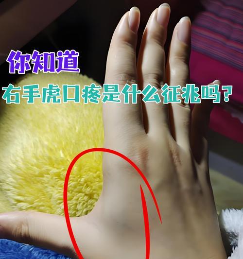 打字手疼应该选择哪种键盘？如何缓解打字带来的手部疲劳？